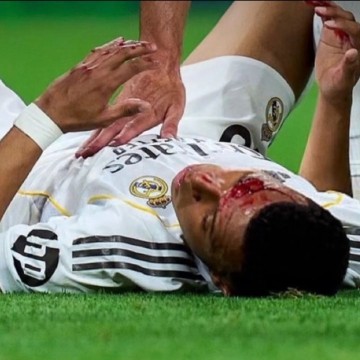 开云体育中心-遭肘击流血！皇马官方：姆巴佩眉骨缝针，缺席球队今日合练